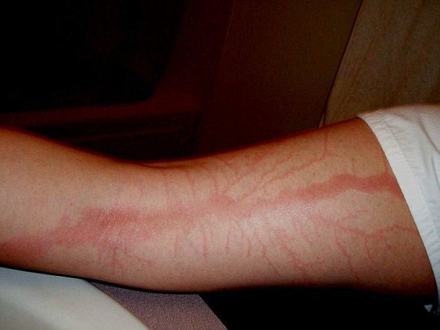 They asked her about her weird scar her answer almost had them fainting | news
